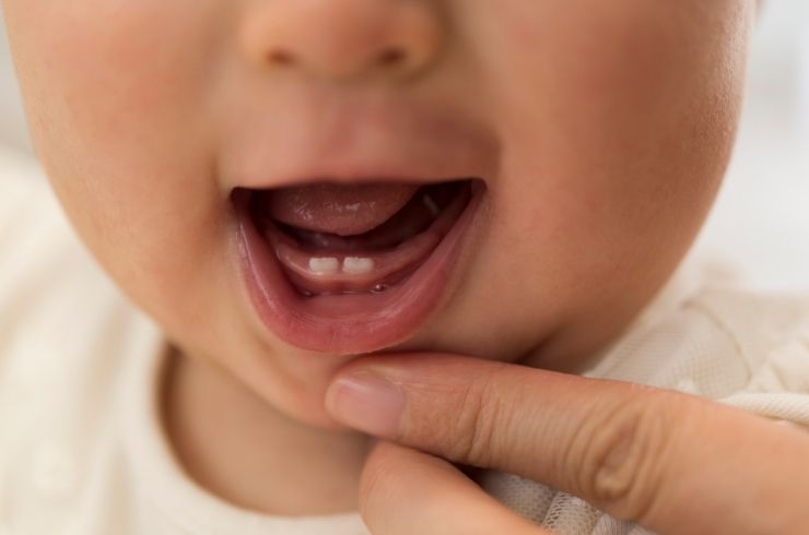 Murari Dental Care
